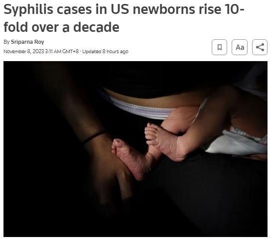 美国新生儿梅毒病例持续激增 十年内增长10倍多