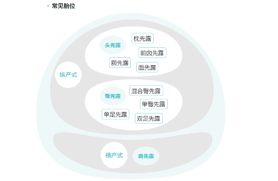 分娩最佳顺产胎位是什么样子？