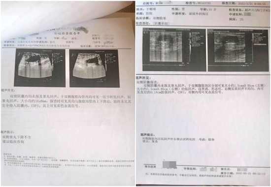 小鱼在洛阳当地医院做的超声报告。